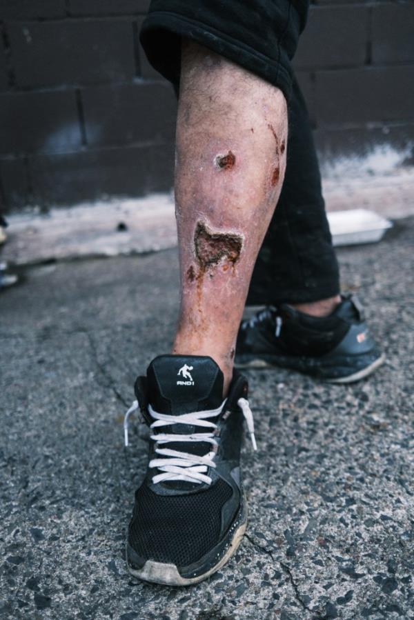 Police at the scene of a road rage shooting involving a former NYPD captain in Brooklyn on Dec. 31, 2023.